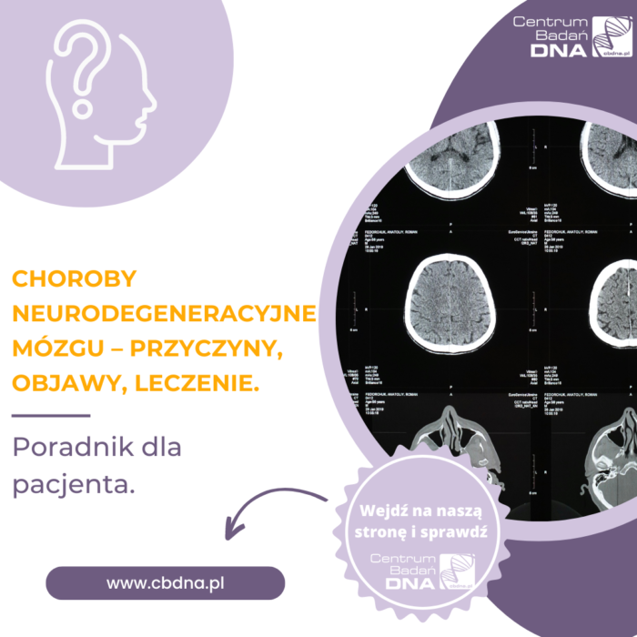 Choroby neurodegeneracyjne mózgu przyczyny objawy leczenie